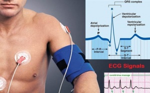 Vai trò của đo điện tâm đồ liên tục trong kiểm soát rối loạn nhịp tim?