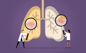 Ung thư phổi và những thông tin hữu ích dành cho bạn!