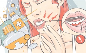 7 mẹo giảm đau do nhiệt miệng