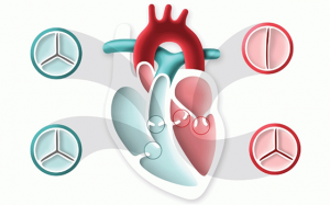 Đâu là van tim hay bị hẹp, hở và dạng nào nguy hiểm nhất?