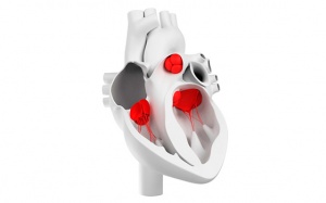 Mức độ và triệu chứng đặc trưng của các bệnh lý hẹp, hở van tim