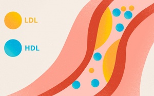 4 bí quyết giúp kiểm soát LDL-cholesterol