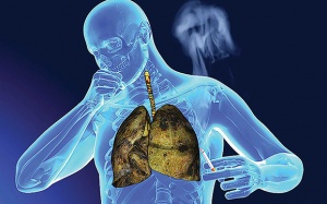 Dấu hiệu cảnh báo nam giới nên tầm soát ung thư phổi