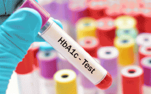 Đái tháo đường: Chỉ số HbA1c 8,2% có cao không, làm sao để hạ?