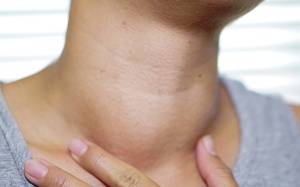 Những điều cần biết về bướu tuyến giáp 