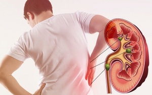 Một vài thói quen hàng ngày có thể dẫn đến chứng thận yếu