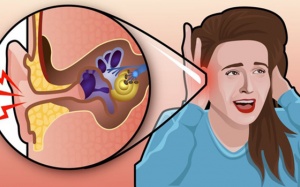 Bị ù tai phải kéo dài, nên làm gì để nhanh hết?