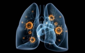 Người khỏe mạnh nhiễm COVID-19 cũng cần cẩn thận nguy cơ di chứng