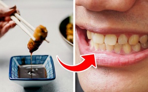 7 thực phẩm gây ố vàng răng bạn nên tránh
