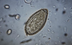 Bệnh đậu mùa khỉ trỗi dậy ở Châu Âu, phát hiện và điều trị sán lá gan nhỏ