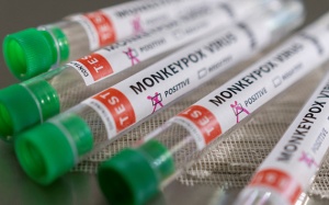 Tăng cường giám sát người về từ quốc gia đang có bệnh đậu mùa khỉ