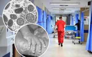 Việt Nam giám sát người đến từ 12 quốc gia lưu hành bệnh đậu mùa khỉ 