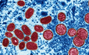 WHO công bố cảnh báo mới nhất về bệnh đậu mùa khỉ 