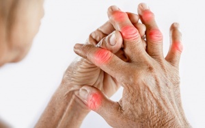 Mách bạn các biện pháp cải thiện bệnh gout ngay tại nhà