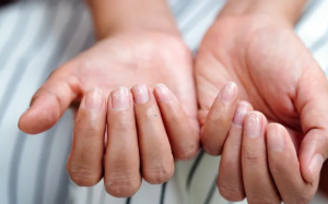 Bạn có đang thiếu sắt? Dấu hiệu cảnh báo và cách cải thiện