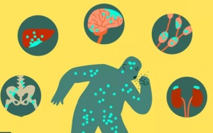 Ung thư phổi có thể di căn đến cơ quan nào?