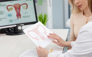 7 dấu hiệu u xơ tử cung mà bạn cần chú ý