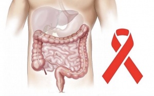 Mỹ thử nghiệm thành công 100% thuốc chữa ung thư trực tràng