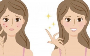 4 bước chăm sóc da giúp cải thiện mụn hiệu quả