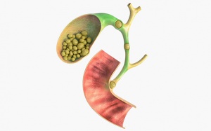 Tìm hiểu về phương pháp tán sỏi ống mật chủ