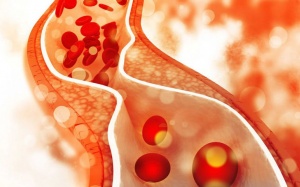 Kiểm soát mỡ máu, ngăn chặn nguy cơ xơ vữa động mạch, biến chứng tim mạch