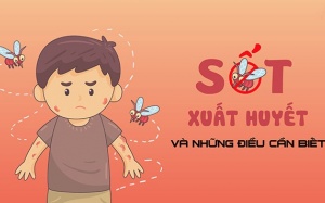 Nên làm gì khi bị sốt xuất huyết