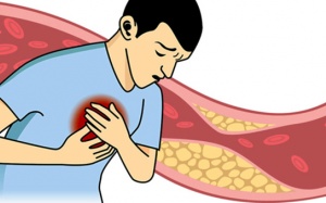 Nguyên nhân gây mỡ máu cao và cách phòng ngừa từ thảo dược