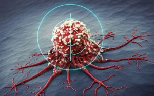 Theranostic - Niềm hy vọng cho những bệnh nhân ung thư di căn