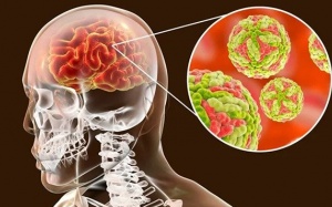 Viêm não vào mùa, phụ huynh cần làm gì để phòng bệnh cho con?