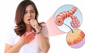 Mách bạn cách cải thiện bệnh viêm phế quản tại nhà