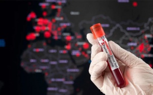 Singapore báo cáo ca nhiễm đậu mùa khỉ thứ 13 kể từ tháng 6