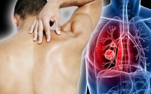 “Điểm mặt” những dấu hiệu cảnh báo bạn có thể mắc ung thư phổi