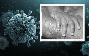 Châu Mỹ trở thành 'tâm chấn' mới của đợt bùng phát dịch đậu mùa khỉ