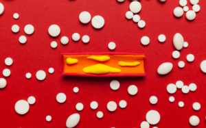 Tắc hẹp mạch vành: Không đặt stent mà dùng thuốc được không?