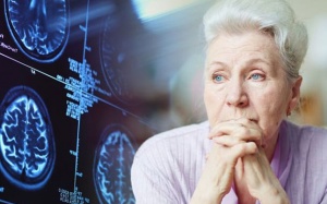 7 dấu hiệu cảnh báo sớm bệnh Alzheimer ở người cao tuổi