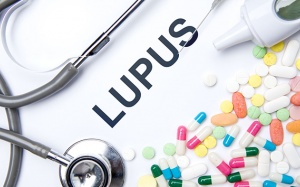 Cải thiện lupus ban đỏ: Đâu là phương pháp hiệu quả?