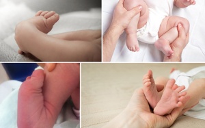 BV Nhi Trung ương: Hỗ trợ phẫu thuật cho trẻ mắc dị tật tay, chân