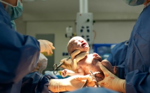 Không nên lạm dụng sinh mổ