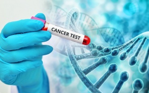 Tầm soát nhiều bệnh ung thư bằng một lần xét nghiệm: Những điều chưa chắc chắn