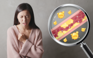 Tăng huyết áp và biến chứng nguy hiểm khi bị xơ vữa động mạch