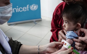 Suy dinh dưỡng cấp tính nặng ở trẻ em: Cần khẩn trương giải quyết