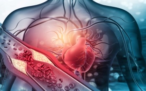 Bệnh máu nhiễm mỡ có chữa được không? 