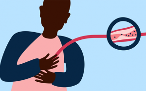 Cách xử trí cơn đau thắt ngực như thế nào?