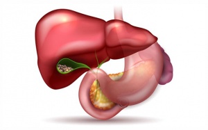 Sỏi mật 22mm điều trị thế nào, dùng TPBVSK Kim Đởm Khang được không?