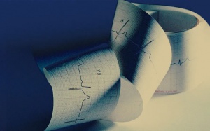 Đốt điện tim có đau không, có khỏi hoàn toàn ngoại tâm thu không?