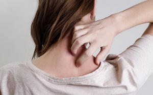 Cách đẩy lùi cơn đau sau zona thần kinh hiệu quả