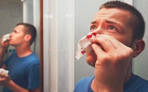 Phải làm gì khi bị chảy máu cam thường xuyên?