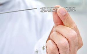 Những điều cần biết về đặt stent động mạch cảnh