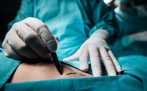 Chuyên gia giải đáp: Mổ nội soi sỏi túi mật giá bao nhiêu? 