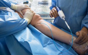 Những thông tin không thể bỏ qua trước khi đặt stent động mạch vành